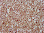 IHC image diluted at 1:400 and staining in paraffin-embedded human brain tissue performed on a Leica BondTM system. After dewaxing and hydration, antigen retrieval was mediated by high pressure in a citrate buffer (pH 6.0). Section was blocked with 10% normal goat serum 30min at RT. Then primary antibody (1% BSA) was incubated at 4°C overnight. The primary is detected by a biotinylated secondary antibody and visualized using an HRP conjugated SP system.