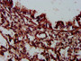 IHC image diluted at 1:300 and staining in paraffin-embedded human lung tissue performed on a Leica BondTM system. After dewaxing and hydration, antigen retrieval was mediated by high pressure in a citrate buffer (pH 6.0). Section was blocked with 10% normal goat serum 30min at RT. Then primary antibody (1% BSA) was incubated at 4°C overnight. The primary is detected by a biotinylated secondary antibody and visualized using an HRP conjugated SP system.