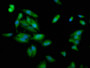 Immunofluorescence staining of Hela cells with CAC11391 at 1:100, counter-stained with DAPI. The cells were fixed in 4% formaldehyde, permeabilized using 0.2% Triton X-100 and blocked in 10% normal Goat Serum. The cells were then incubated with the antibody overnight at 4°C. The secondary antibody was Alexa Fluor 488-congugated AffiniPure Goat Anti-Rabbit IgG(H+L).