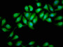 Immunofluorescence staining of A549 cells with CAC11392 at 1:166, counter-stained with DAPI. The cells were fixed in 4% formaldehyde, permeabilized using 0.2% Triton X-100 and blocked in 10% normal Goat Serum. The cells were then incubated with the antibody overnight at 4°C. The secondary antibody was Alexa Fluor 488-congugated AffiniPure Goat Anti-Rabbit IgG(H+L).