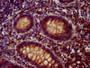 IHC image of CAC11397 diluted at 1:400 and staining in paraffin-embedded human appendix tissue performed on a Leica BondTM system. After dewaxing and hydration, antigen retrieval was mediated by high pressure in a citrate buffer (pH 6.0). Section was blocked with 10% normal goat serum 30min at RT. Then primary antibody (1% BSA) was incubated at 4°C overnight. The primary is detected by a biotinylated secondary antibody and visualized using an HRP conjugated SP system.