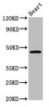 Western Blot; Positive WB detected in: Mouse heart tissue; All lanes: CERS3 antibody at 3.6µg/ml; Secondary; Goat polyclonal to rabbit IgG at 1/50000 dilution; Predicted band size: 47 kDa; Observed band size: 47 kDa;