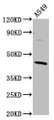 Western Blot; Positive WB detected in: A549 whole cell lysate; All lanes: ELMOD3 antibody at 4.3µg/ml; Secondary; Goat polyclonal to rabbit IgG at 1/50000 dilution; Predicted band size: 44, 29, 19, 21, 45 kDa; Observed band size: 44 kDa