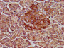IHC image diluted at 1:500 and staining in paraffin-embedded human pancreatic tissue performed on a Leica BondTM system. After dewaxing and hydration, antigen retrieval was mediated by high pressure in a citrate buffer (pH 6.0). Section was blocked with 10% normal goat serum 30min at RT. Then primary antibody (1% BSA) was incubated at 4°C overnight. The primary is detected by a biotinylated secondary antibody and visualized using an HRP conjugated SP system.