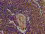 IHC image diluted at 1:400 and staining in paraffin-embedded human spleen tissue performed on a Leica BondTM system. After dewaxing and hydration, antigen retrieval was mediated by high pressure in a citrate buffer (pH 6.0). Section was blocked with 10% normal goat serum 30min at RT. Then primary antibody (1% BSA) was incubated at 4°C overnight. The primary is detected by a biotinylated secondary antibody and visualized using an HRP conjugated SP system.