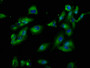 Immunofluorescence staining of Hela cells with CAC11411 at 1:100, counter-stained with DAPI. The cells were fixed in 4% formaldehyde, permeabilized using 0.2% Triton X-100 and blocked in 10% normal Goat Serum. The cells were then incubated with the antibody overnight at 4°C. The secondary antibody was Alexa Fluor 488-congugated AffiniPure Goat Anti-Rabbit IgG(H+L).