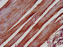 IHC image of CAC11413 diluted at 1:500 and staining in paraffin-embedded human skeletal muscle tissue performed on a Leica BondTM system. After dewaxing and hydration, antigen retrieval was mediated by high pressure in a citrate buffer (pH 6.0). Section was blocked with 10% normal goat serum 30min at RT. Then primary antibody (1% BSA) was incubated at 4°C overnight. The primary is detected by a biotinylated secondary antibody and visualized using an HRP conjugated SP system.