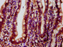 IHC image diluted at 1:500 and staining in paraffin-embedded human small intestine tissue performed on a Leica BondTM system. After dewaxing and hydration, antigen retrieval was mediated by high pressure in a citrate buffer (pH 6.0). Section was blocked with 10% normal goat serum 30min at RT. Then primary antibody (1% BSA) was incubated at 4°C overnight. The primary is detected by a biotinylated secondary antibody and visualized using an HRP conjugated SP system.