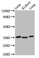 Western Blot; Positive WB detected in: Rat lung tissue, Rat kidney tissue, Mouse lung tissue; All lanes: HOXD1 antibody at 2.4µg/ml; Secondary; Goat polyclonal to rabbit IgG at 1/50000 dilution; Predicted band size: 35 kDa; Observed band size: 35 kDa;