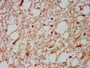 IHC image diluted at 1:600 and staining in paraffin-embedded human brain tissue performed on a Leica BondTM system. After dewaxing and hydration, antigen retrieval was mediated by high pressure in a citrate buffer (pH 6.0). Section was blocked with 10% normal goat serum 30min at RT. Then primary antibody (1% BSA) was incubated at 4°C overnight. The primary is detected by a biotinylated secondary antibody and visualized using an HRP conjugated SP system.