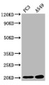 Western Blot; Positive WB detected in: PC-3 whole cell lysate, A549 whole cell lysate; All lanes: SNX12 antibody at 2.83µg/ml; Secondary; Goat polyclonal to rabbit IgG at 1/50000 dilution; Predicted band size: 20, 19 kDa; Observed band size: 20 kDa