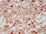 IHC image diluted at 1:300 and staining in paraffin-embedded human brain tissue performed on a Leica BondTM system. After dewaxing and hydration, antigen retrieval was mediated by high pressure in a citrate buffer (pH 6.0). Section was blocked with 10% normal goat serum 30min at RT. Then primary antibody (1% BSA) was incubated at 4°C overnight. The primary is detected by a biotinylated secondary antibody and visualized using an HRP conjugated SP system.