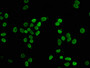 Immunofluorescence staining of Hela cells (treated with 30mM sodium butyrate for 4h) with CAC11431 at 1:37.5, counter-stained with DAPI. The cells were fixed in 4% formaldehyde, permeabilized using 0.2% Triton X-100 and blocked in 10% normal Goat Serum. The cells were then incubated with the antibody overnight at 4°C. The secondary antibody was Alexa Fluor 488-congugated AffiniPure Goat Anti-Rabbit IgG(H+L).