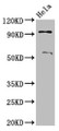 Western Blot; Positive WB detected in: Hela whole cell lysate; All lanes: ADAM23 antibody at 3.2µg/ml; Secondary; Goat polyclonal to rabbit IgG at 1/50000 dilution; Predicted band size: 92, 93 kDa; Observed band size: 92 kDa
