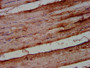 IHC image diluted at 1:500 and staining in paraffin-embedded human skeletal muscle tissue performed on a Leica BondTM system. After dewaxing and hydration, antigen retrieval was mediated by high pressure in a citrate buffer (pH 6.0). Section was blocked with 10% normal goat serum 30min at RT. Then primary antibody (1% BSA) was incubated at 4°C overnight. The primary is detected by a biotinylated secondary antibody and visualized using an HRP conjugated SP system.