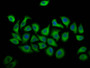 Immunofluorescence staining of A549 cells with CAC11434 at 1:166, counter-stained with DAPI. The cells were fixed in 4% formaldehyde, permeabilized using 0.2% Triton X-100 and blocked in 10% normal Goat Serum. The cells were then incubated with the antibody overnight at 4°C. The secondary antibody was Alexa Fluor 488-congugated AffiniPure Goat Anti-Rabbit IgG(H+L).