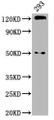 Western Blot; Positive WB detected in: 293 whole cell lysate; All lanes: CDH1 antibody at 2.9µg/ml; Secondary; Goat polyclonal to rabbit IgG at 1/50000 dilution; Predicted band size: 98, 91 kDa; Observed band size: 125 kDa Western Blot; Positive WB detected in: 293 whole cell lysate; All lanes: CDH1 antibody at 2.9µg/ml; Secondary; Goat polyclonal to rabbit IgG at 1/50000 dilution; Predicted band size: 98, 91 kDa; Observed band size: 125 kDa