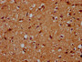 IHC image diluted at 1:200 and staining in paraffin-embedded human brain tissue performed on a Leica BondTM system. After dewaxing and hydration, antigen retrieval was mediated by high pressure in a citrate buffer (pH 6.0). Section was blocked with 10% normal goat serum 30min at RT. Then primary antibody (1% BSA) was incubated at 4°C overnight. The primary is detected by a biotinylated secondary antibody and visualized using an HRP conjugated SP system. IHC image diluted at 1:200 and staining in paraffin-embedded human brain tissue performed on a Leica BondTM system. After dewaxing and hydration, antigen retrieval was mediated by high pressure in a citrate buffer (pH 6.0). Section was blocked with 10% normal goat serum 30min at RT. Then primary antibody (1% BSA) was incubated at 4°C overnight. The primary is detected by a biotinylated secondary antibody and visualized using an HRP conjugated SP system.
