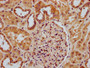 IHC image diluted at 1:300 and staining in paraffin-embedded human kidney tissue performed on a Leica BondTM system. After dewaxing and hydration, antigen retrieval was mediated by high pressure in a citrate buffer (pH 6.0). Section was blocked with 10% normal goat serum 30min at RT. Then primary antibody (1% BSA) was incubated at 4°C overnight. The primary is detected by a biotinylated secondary antibody and visualized using an HRP conjugated SP system.