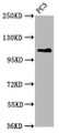 Western Blot; Positive WB detected in: PC-3 whole cell lysate; All lanes: FAN1 antibody at 5.3µg/ml; Secondary; Goat polyclonal to rabbit IgG at 1/50000 dilution; Predicted band size: 115, 60 kDa; Observed band size: 115 kDa;