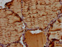IHC image of CAC11446 diluted at 1:100 and staining in paraffin-embedded human thyroid tissue performed on a Leica BondTM system. After dewaxing and hydration, antigen retrieval was mediated by high pressure in a citrate buffer (pH 6.0). Section was blocked with 10% normal goat serum 30min at RT. Then primary antibody (1% BSA) was incubated at 4°C overnight. The primary is detected by a biotinylated secondary antibody and visualized using an HRP conjugated SP system.