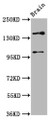 Western Blot; Positive WB detected in: Rat brain tissue; All lanes: SOS1 antibody at 4.6µg/ml; Secondary; Goat polyclonal to rabbit IgG at 1/50000 dilution; Predicted band size: 153, 37 kDa; Observed band size: 153 kDa;