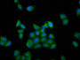Immunofluorescence staining of Hela cells with CAC11456 at 1:133, counter-stained with DAPI. The cells were fixed in 4% formaldehyde, permeabilized using 0.2% Triton X-100 and blocked in 10% normal Goat Serum. The cells were then incubated with the antibody overnight at 4°C. The secondary antibody was Alexa Fluor 488-congugated AffiniPure Goat Anti-Rabbit IgG(H+L).