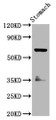 Western Blot; Positive WB detected in: Rat stomach tissue; All lanes: SLC5A5 antibody at 3.7µg/ml; Secondary; Goat polyclonal to rabbit IgG at 1/50000 dilution; Predicted band size: 69 kDa; Observed band size: 69 kDa; Western Blot; Positive WB detected in: Rat stomach tissue; All lanes: SLC5A5 antibody at 3.7µg/ml; Secondary; Goat polyclonal to rabbit IgG at 1/50000 dilution; Predicted band size: 69 kDa; Observed band size: 69 kDa;