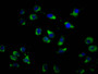 Immunofluorescence staining of A549 cells with CAC11471 at 1:100, counter-stained with DAPI. The cells were fixed in 4% formaldehyde, permeabilized using 0.2% Triton X-100 and blocked in 10% normal Goat Serum. The cells were then incubated with the antibody overnight at 4°C. The secondary antibody was Alexa Fluor 488-congugated AffiniPure Goat Anti-Rabbit IgG(H+L).