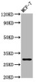 Western Blot; Positive WB detected in: MCF-7 whole cell lysate; All lanes: MYOZ2 antibody at 4.31µg/ml; Secondary; Goat polyclonal to rabbit IgG at 1/50000 dilution; Predicted band size: 30 kDa; Observed band size: 30 kDa