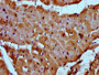 IHC image diluted at 1:300 and staining in paraffin-embedded human heart tissue performed on a Leica BondTM system. After dewaxing and hydration, antigen retrieval was mediated by high pressure in a citrate buffer (pH 6.0). Section was blocked with 10% normal goat serum 30min at RT. Then primary antibody (1% BSA) was incubated at 4°C overnight. The primary is detected by a biotinylated secondary antibody and visualized using an HRP conjugated SP system.