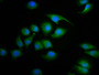 Immunofluorescence staining of A549 cells with CAC11476 at 1:100, counter-stained with DAPI. The cells were fixed in 4% formaldehyde, permeabilized using 0.2% Triton X-100 and blocked in 10% normal Goat Serum. The cells were then incubated with the antibody overnight at 4°C. The secondary antibody was Alexa Fluor 488-congugated AffiniPure Goat Anti-Rabbit IgG(H+L).