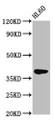 Western Blot; Positive WB detected in: HL60 whole cell lysate; All lanes: GPR174 antibody at 2.8µg/ml; Secondary; Goat polyclonal to rabbit IgG at 1/50000 dilution; Predicted band size: 39 kDa; Observed band size: 39 kDa