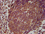 IHC image diluted at 1:300 and staining in paraffin-embedded human lymph node tissue performed on a Leica BondTM system. After dewaxing and hydration, antigen retrieval was mediated by high pressure in a citrate buffer (pH 6.0). Section was blocked with 10% normal goat serum 30min at RT. Then primary antibody (1% BSA) was incubated at 4°C overnight. The primary is detected by a biotinylated secondary antibody and visualized using an HRP conjugated SP system.