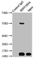 Immunoprecipitating HIST1H4A in Hela whole cell lysate; , Lane 1: Rabbit control IgG instead in Hela whole cell lysate. For western blotting, a HRP-conjugated Protein G antibody was used as the secondary antibody (1/2000); , Lane 2: CAC11484 (3µg) + Hela whole cell lysate (500µg); , Lane 3: Hela whole cell lysate (20µg)