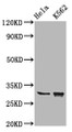 Western Blot; Positive WB detected in: Hela whole cell lysate, K562 whole cell lysate; All lanes: CHODL antibody at 6.2µg/ml; Secondary; Goat polyclonal to rabbit IgG at 1/50000 dilution; Predicted band size: 31, 26, 28, 29 kDa; Observed band size: 31 kDa Western Blot; Positive WB detected in: Hela whole cell lysate, K562 whole cell lysate; All lanes: CHODL antibody at 6.2µg/ml; Secondary; Goat polyclonal to rabbit IgG at 1/50000 dilution; Predicted band size: 31, 26, 28, 29 kDa; Observed band size: 31 kDa