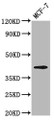 Western Blot; Positive WB detected in: MCF-7 whole cell lysate; All lanes: OPN1MW antibody at 3.2µg/ml; Secondary; Goat polyclonal to rabbit IgG at 1/50000 dilution; Predicted band size: 41 kDa; Observed band size: 41 kDa
