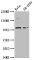 Western Blot; Positive WB detected in: Hela whole cell lysate, SH-SY5Y whole cell lysate; All lanes: PDE6C antibody at 3.7µg/ml; Secondary; Goat polyclonal to rabbit IgG at 1/50000 dilution; Predicted band size: 100 kDa; Observed band size: 100 kDa;