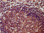 IHC image diluted at 1:400 and staining in paraffin-embedded human lymph node tissue performed on a Leica BondTM system. After dewaxing and hydration, antigen retrieval was mediated by high pressure in a citrate buffer (pH 6.0). Section was blocked with 10% normal goat serum 30min at RT. Then primary antibody (1% BSA) was incubated at 4°C overnight. The primary is detected by a biotinylated secondary antibody and visualized using an HRP conjugated SP system.