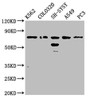 Western Blot; Positive WB detected in: K562 whole cell lysate, Colo320 whole cell lysate, SH-SY5Y whole cell lysate, A549 whole cell lysate, PC-3 whole cell lysate; All lanes: BRINP3 antibody at 3.8µg/ml; Secondary; Goat polyclonal to rabbit IgG at 1/50000 dilution; Predicted band size: 89, 77 kDa; Observed band size: 77 kDa