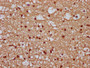 IHC image diluted at 1:300 and staining in paraffin-embedded human brain tissue performed on a Leica BondTM system. After dewaxing and hydration, antigen retrieval was mediated by high pressure in a citrate buffer (pH 6.0). Section was blocked with 10% normal goat serum 30min at RT. Then primary antibody (1% BSA) was incubated at 4°C overnight. The primary is detected by a biotinylated secondary antibody and visualized using an HRP conjugated SP system.