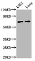 Western Blot; Positive WB detected in: K562 whole cell lysate, Rat lung tissue; All lanes: POF1B antibody at 3.4µg/ml; Secondary; Goat polyclonal to rabbit IgG at 1/50000 dilution; Predicted band size: 69, 35 kDa; Observed band size: 69 kDa Western Blot; Positive WB detected in: K562 whole cell lysate, Rat lung tissue; All lanes: POF1B antibody at 3.4µg/ml; Secondary; Goat polyclonal to rabbit IgG at 1/50000 dilution; Predicted band size: 69, 35 kDa; Observed band size: 69 kDa