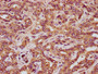 IHC image diluted at 1:200 and staining in paraffin-embedded human liver tissue performed on a Leica BondTM system. After dewaxing and hydration, antigen retrieval was mediated by high pressure in a citrate buffer (pH 6.0). Section was blocked with 10% normal goat serum 30min at RT. Then primary antibody (1% BSA) was incubated at 4°C overnight. The primary is detected by a biotinylated secondary antibody and visualized using an HRP conjugated SP system.