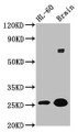 Western Blot; Positive WB detected in: HL60 whole cell lysate, Rat brain tissue; All lanes: FEV antibody at 5.9µg/ml; Secondary; Goat polyclonal to rabbit IgG at 1/50000 dilution; Predicted band size: 26 kDa; Observed band size: 26 kDa