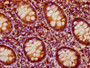 IHC image of CAC11516 diluted at 1:200 and staining in paraffin-embedded human appendix tissue performed on a Leica BondTM system. After dewaxing and hydration, antigen retrieval was mediated by high pressure in a citrate buffer (pH 6.0). Section was blocked with 10% normal goat serum 30min at RT. Then primary antibody (1% BSA) was incubated at 4°C overnight. The primary is detected by a biotinylated secondary antibody and visualized using an HRP conjugated SP system.