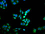 Immunofluorescence staining of PC-3 cells with CAC11517 at 1:166, counter-stained with DAPI. The cells were fixed in 4% formaldehyde, permeabilized using 0.2% Triton X-100 and blocked in 10% normal Goat Serum. The cells were then incubated with the antibody overnight at 4°C. The secondary antibody was Alexa Fluor 488-congugated AffiniPure Goat Anti-Rabbit IgG(H+L).