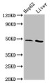 Western Blot; Positive WB detected in: HepG2 whole cell lysate, Rat liver tissue; All lanes: APMAP antibody at 3.1µg/ml; Secondary; Goat polyclonal to rabbit IgG at 1/50000 dilution; Predicted band size: 47, 33 kDa; Observed band size: 47 kDa