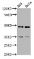 Western Blot; Positive WB detected in: 293 whole cell lysate, Hela whole cell lysate; All lanes: TES antibody at 2.92µg/ml; Secondary; Goat polyclonal to rabbit IgG at 1/50000 dilution; Predicted band size: 48, 47 kDa; Observed band size: 48 kDa