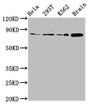 Western Blot; Positive WB detected in: Hela whole cell lysate, 293T whole cell lysate, K562 whole cell lysate, Rat brain tissue; All lanes: MKLN1 antibody at 2.7µg/ml; Secondary; Goat polyclonal to rabbit IgG at 1/50000 dilution; Predicted band size: 85, 61 kDa; Observed band size: 85 kDa