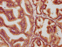 IHC image diluted at 1:400 and staining in paraffin-embedded human prostate tissue performed on a Leica BondTM system. After dewaxing and hydration, antigen retrieval was mediated by high pressure in a citrate buffer (pH 6.0). Section was blocked with 10% normal goat serum 30min at RT. Then primary antibody (1% BSA) was incubated at 4°C overnight. The primary is detected by a biotinylated secondary antibody and visualized using an HRP conjugated SP system.